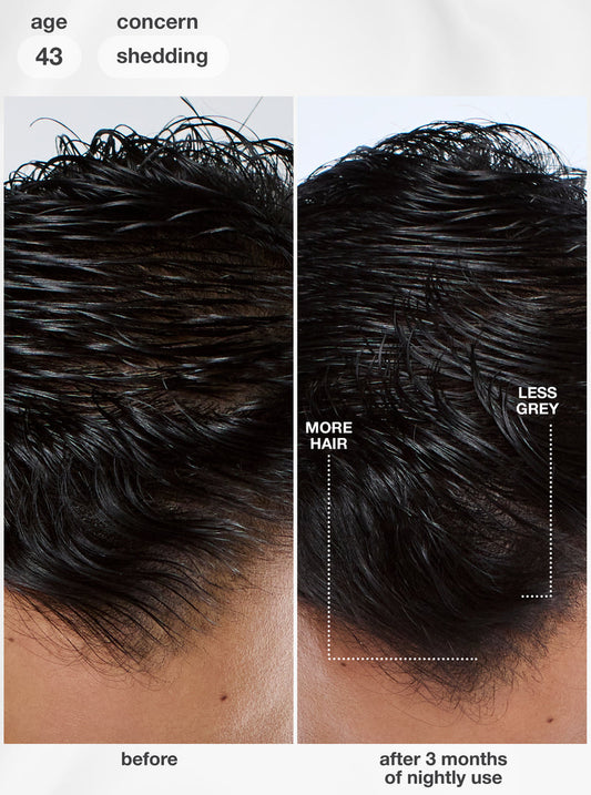 K18 FutureIQ biomimetic hair longevity serum 90ml