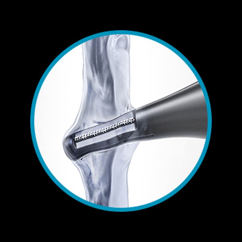 Wahl Precision Vertical Trimmer for Ear/Nose/Brow Battery Operated Trimmer WA5545-2212